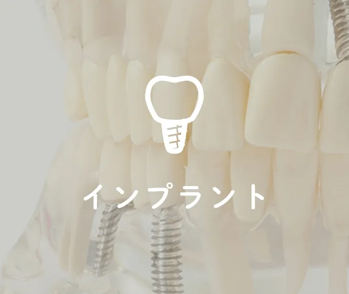 インプラント